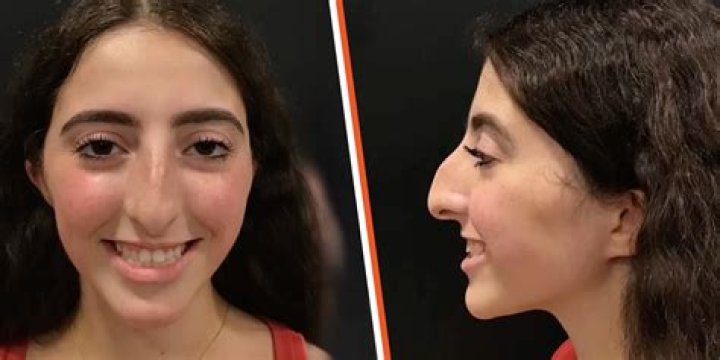 
What Happened To Yasmin Vossoughian’s Face – Did She Get A Face Lift? 